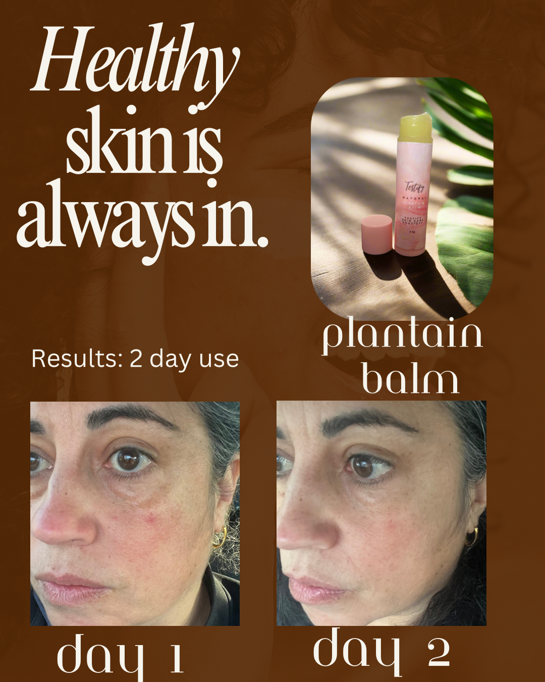 Plantain Balm-All Natural